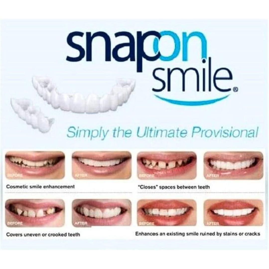 Snap On Fake Teeth White ABS Comfort Fit