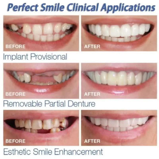 Snap On Fake Teeth White ABS Comfort Fit